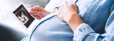 My baby is overdue. Should I be induced?